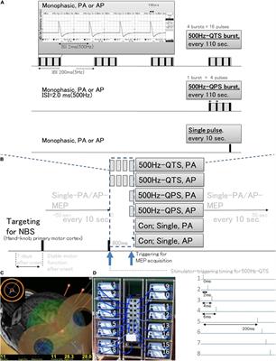 Monophasic-Quadripulse Theta Burst Magnetic Stimulation for Motor Palsy Functional Evaluation After Intracerebral Hemorrhage